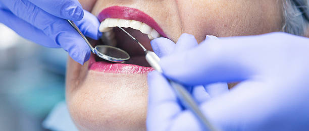 Best Emergency Broken Tooth Repair in Samsula Spruce Creek, FL